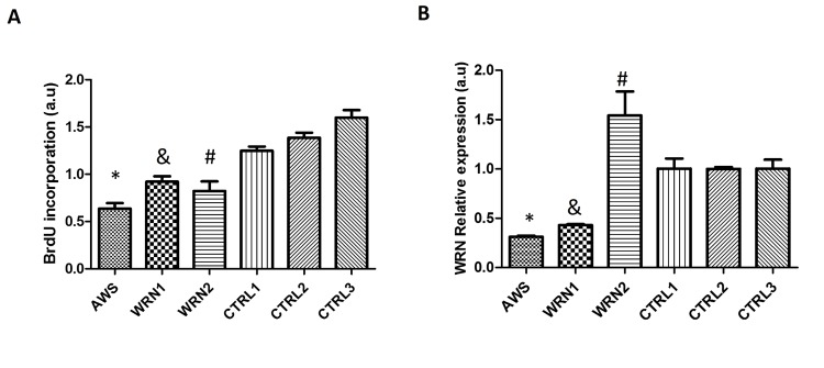 Characterization of atypical Werner Syndrome and Werner Syndrome fibroblasts