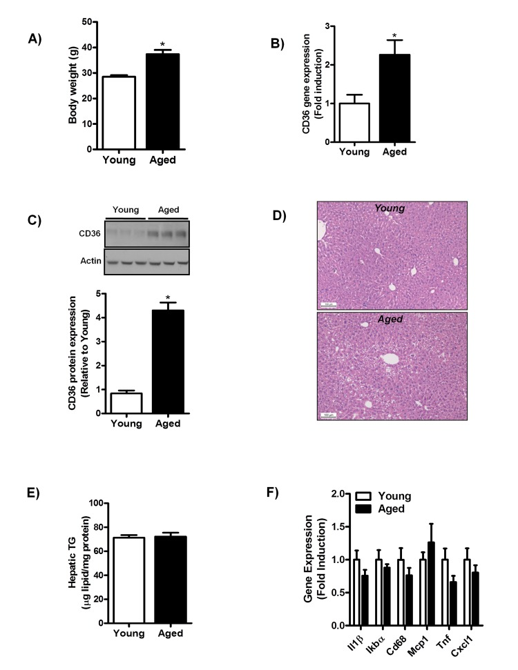 Aging does not trigger the development of hepatic steatosis and inflammation in mice fed a chow diet for one year