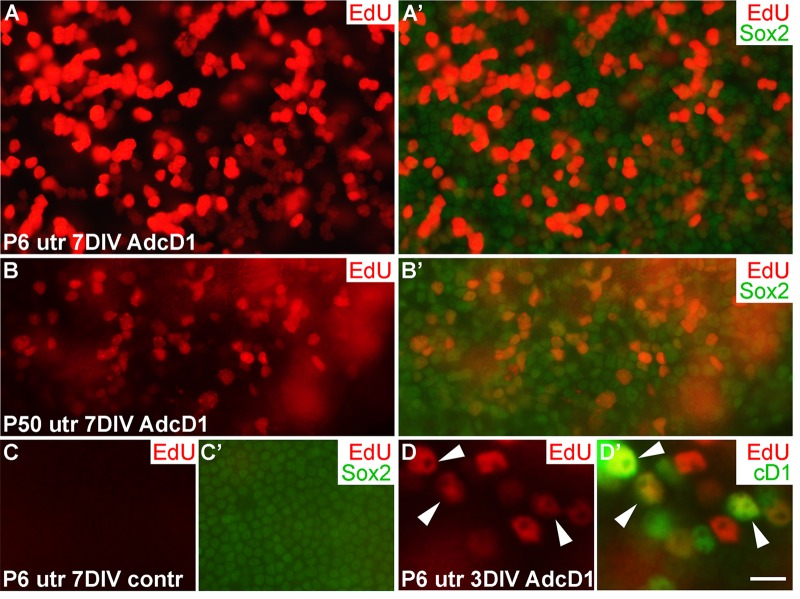 Proliferative response of juvenile and adult utricular supporting cells to cyclin D1 overexpression. Explants were pulsed with EdU for 24 h between days 2 and 3, and analyzed at 3 and 7 DIV. (A,A') AdcD1-infected P6 utricle displays high numbers of EdU+/Sox2+ SCs. (B,B') AdcD1-infected P50 utricle shows lower numbers of EdU+ SCs. (C,C') Non-infected utricular explant is devoid of proliferating SCs. (D,D') The AdcD1-infected P6 utricle shows EdU+/cD1+ SCs (arrowheads). In addition, there are only EdU-positive and only cD1-positive SCs due to cell cycle dynamics and EdU pulsing (see Results). Abbreviations: AdcD1, adenovirus encoding cyclin D1; utr, utricle. Scale bar, shown in D': A-C', 20 µm; D,D', 8 µm.