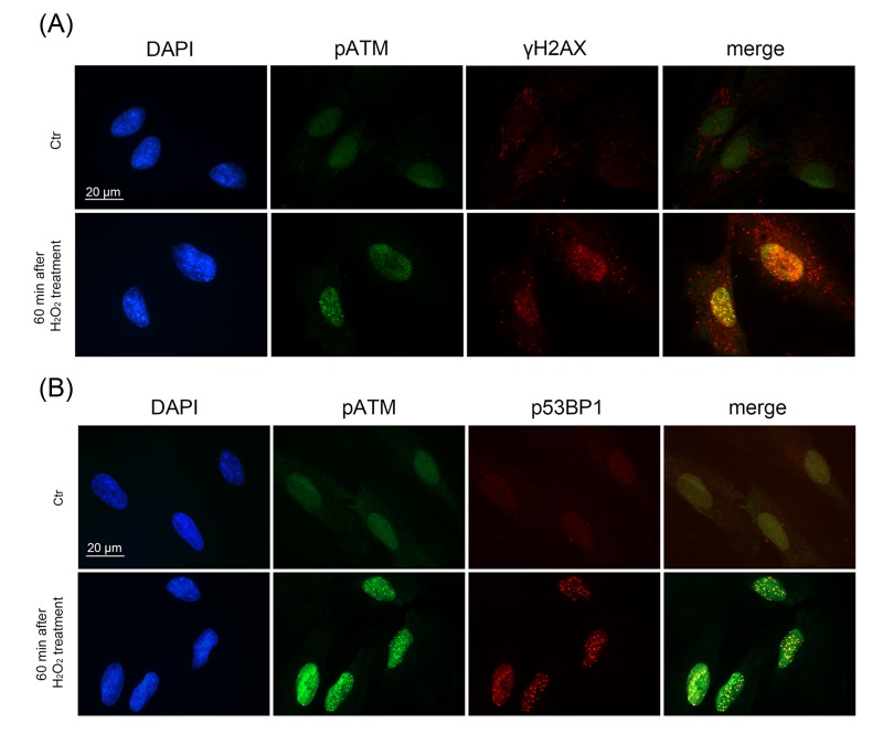 Formation of DNA damage foci containing pATM, γH2AX, p53BP1 in H2O2-treated hMESCs