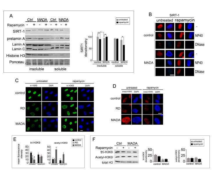 Chromatin-associated proteins affected in MADA are rescued by rapamycin