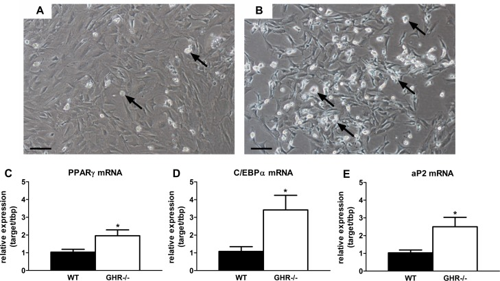 Preadipocyte differentiation is preserved in long-lived GHR-/- mice. (A) Representative image of ING preadipocyte differentiation from 20-month old female wild-type mice following exposure to differentiation media for 48 hours. (B) Representative image of ING preadipocyte differentiation from 20-month old female GHR-/- mice following exposure to differentiation media for 48 hours. (C) PPARγ mRNA expression in differentiating ING preadipocytes from female GHR-/- and age-matched wild-type (WT) littermates. (D) C/EBPα mRNA expression in differentiating ING preadipocytes from female GHR-/- and age-matched wild-type (WT) littermates. E. aP2 mRNA expression in differentiating ING preadipocytes from female GHR-/- and age-matched wild-type (WT) littermates. Data were analyzed by Student's t-test and are expressed as mean ± SEM of 4 mice per group. Scale Bar: A-B=100μm; Arrows indicate differentiating cells, which contain doubly bi-refractile lipid droplets.*P