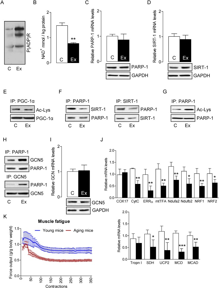 SIRT-1 dysregulation in aged mice increases skeletal muscle fatigue