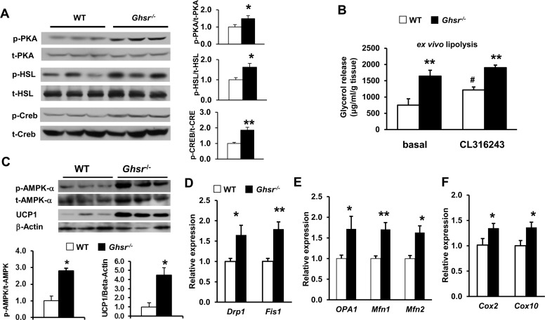 Ablation of GHS-R activates thermogenic signaling cascade and improves mitochondrial dynamics of BAT in aged mice