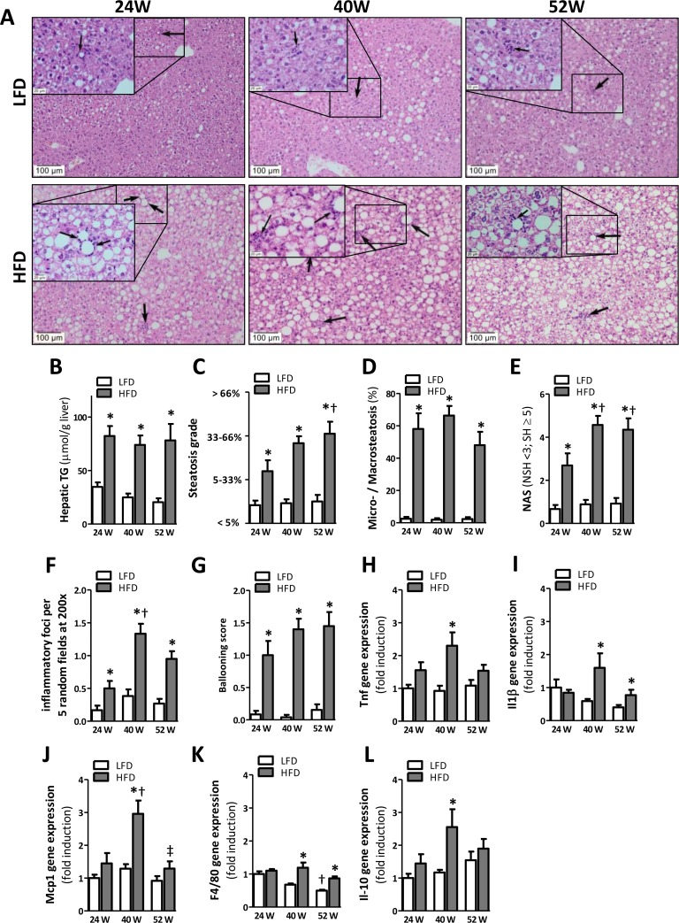 HFD-feeding leads to hepatic steatosis after 24 weeks but inflammation becomes apparent after 40 weeks