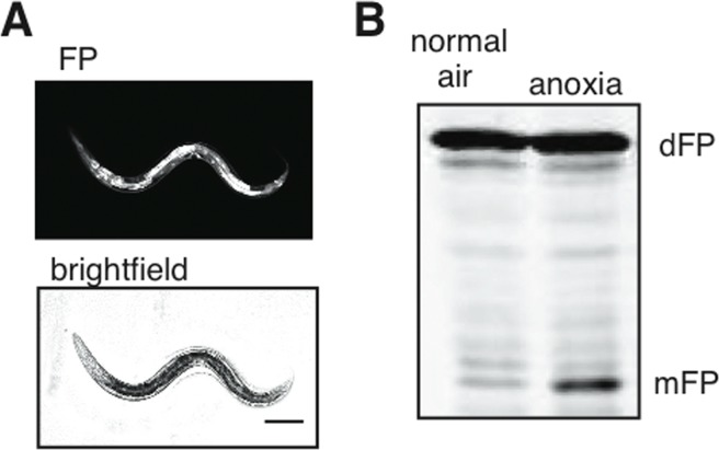 Cytoplasmic flux through the autophagic pathway