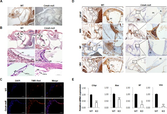 Age-related inner ear abnormality and neuron cell loss in Cmah-null mice