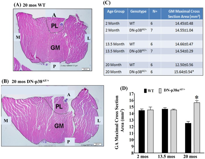 Cross sections of the gastrocnemius of 20-months old (A) WT and (B) DN-p38αAF/+ mice