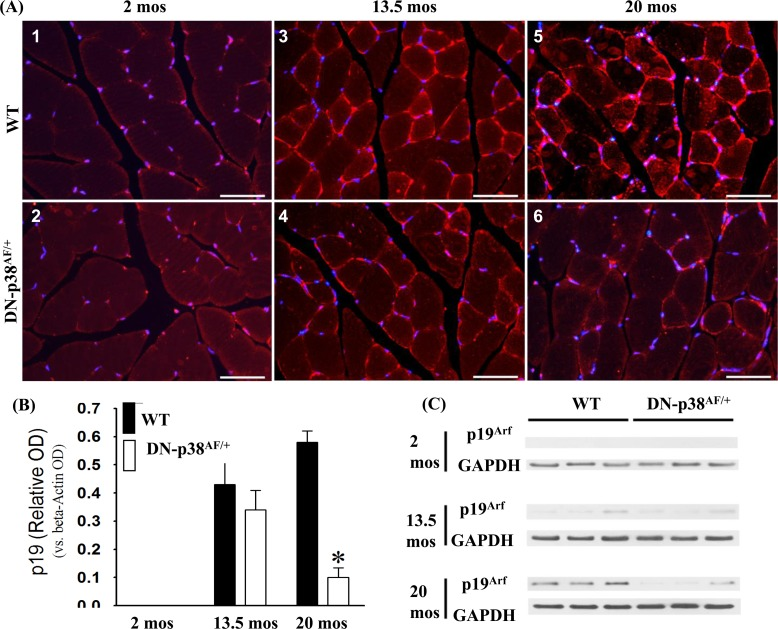 Expression of the p19Arf tumor suppressor gene in the gastrocnemius of young (2 mos), middle aged (13.5 mos) and aged (20 mos) WT and DN-p38αAF/+ mice