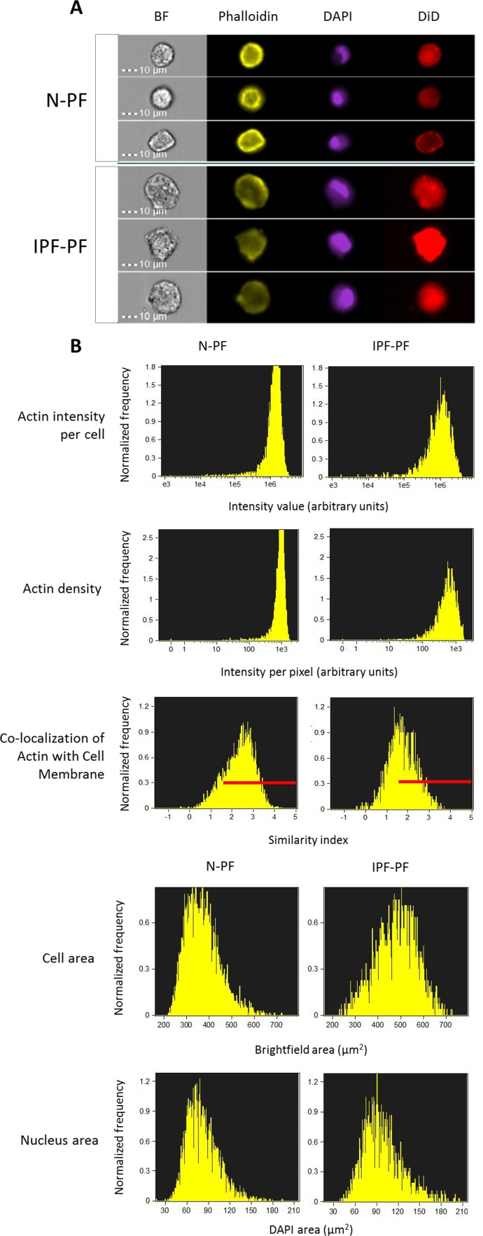 Morphology analysis of lung fibroblasts by ImageStreamX