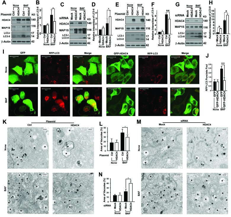 HDAC4 inhibits autophagy flux