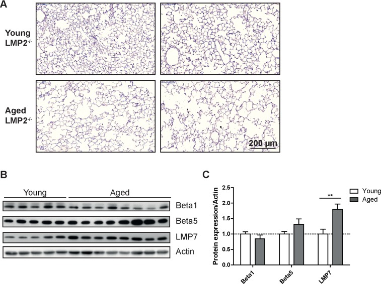 Aged LMP2 knockout mice show senile emphysema in the lung