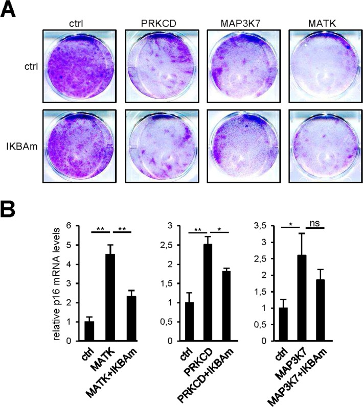 NF-κB target induction is not the sole mediator of senescence by the pro-senescence kinases