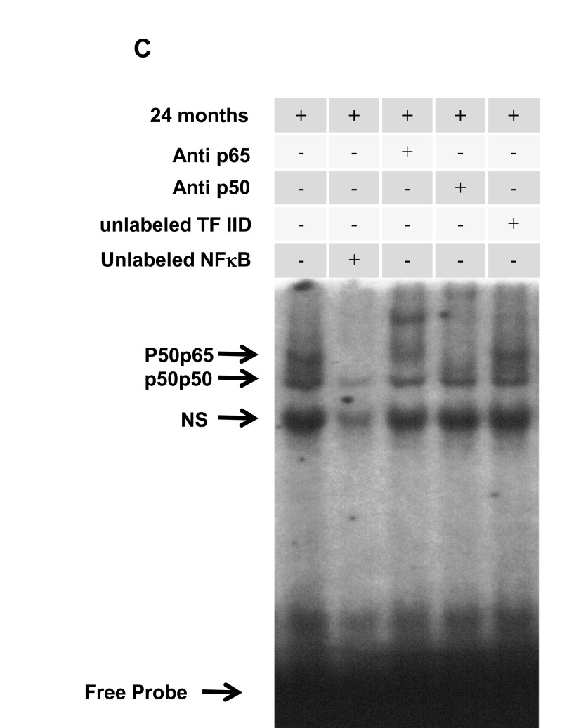 Age-related NF-κB activation in rat hippocampus