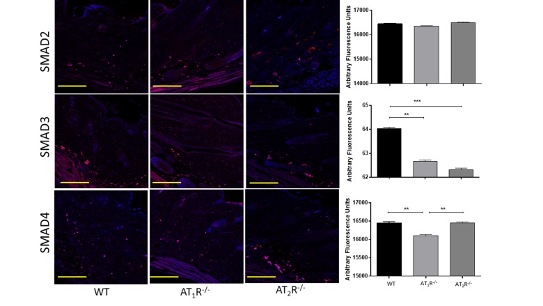 Changes in the TGFβ downstream signaling proteins in wounds of AT1R−/− and AT2R−/− mice. AT1R−/− mice have lower expression of Smad3 and the common mediator Smad4 in healed skin (day20) as compared to WT. A decrease in the expression of Smad3 was also observed in the AT2R−/− mice. The photomicrographs presented in red fluorescent staining with a blue DAPI counter stain for nuclei at 10x magnification. Quantification of mean fluorescence intensity of Smads in wild-type and mutant mice is shown. Scale bar 200 μm. **p