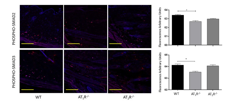 Changes in levels of phosphorylated TGFβ downstream signaling proteins in wounds of AT1R−/− and AT2R−/− mice. AT1R−/− mice have lower expression of Phospho-Smad2 and Phospho-Smad3 in healed skin (day20) as compared to WT. The photomicrographs presented in red fluorescent staining with a blue DAPI counter stain for nuclei at 10x magnification. Quantification of mean fluorescence intensity of phospho-Smads in wild-type and mutant mice is shown. Scale bar 200 μm. *p