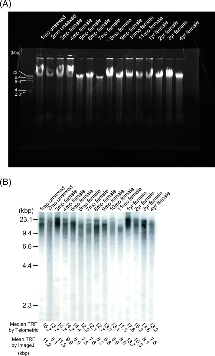 TRF length from embryo to extreme old age in the medaka