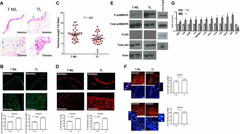 Cellular senescence in TL vs TNIL