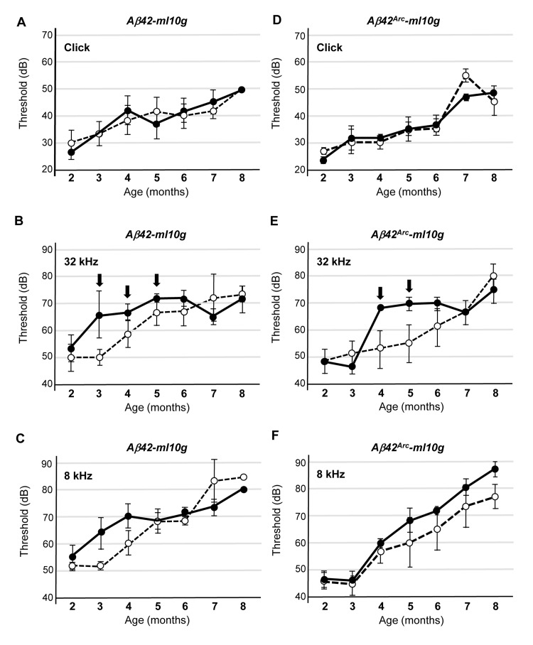 Tg(Math1E-Aβ42)1Lt and Tg(Math1E-Aβ42Arc)1Lt mice show slight hearing defects in high-frequency sound perception