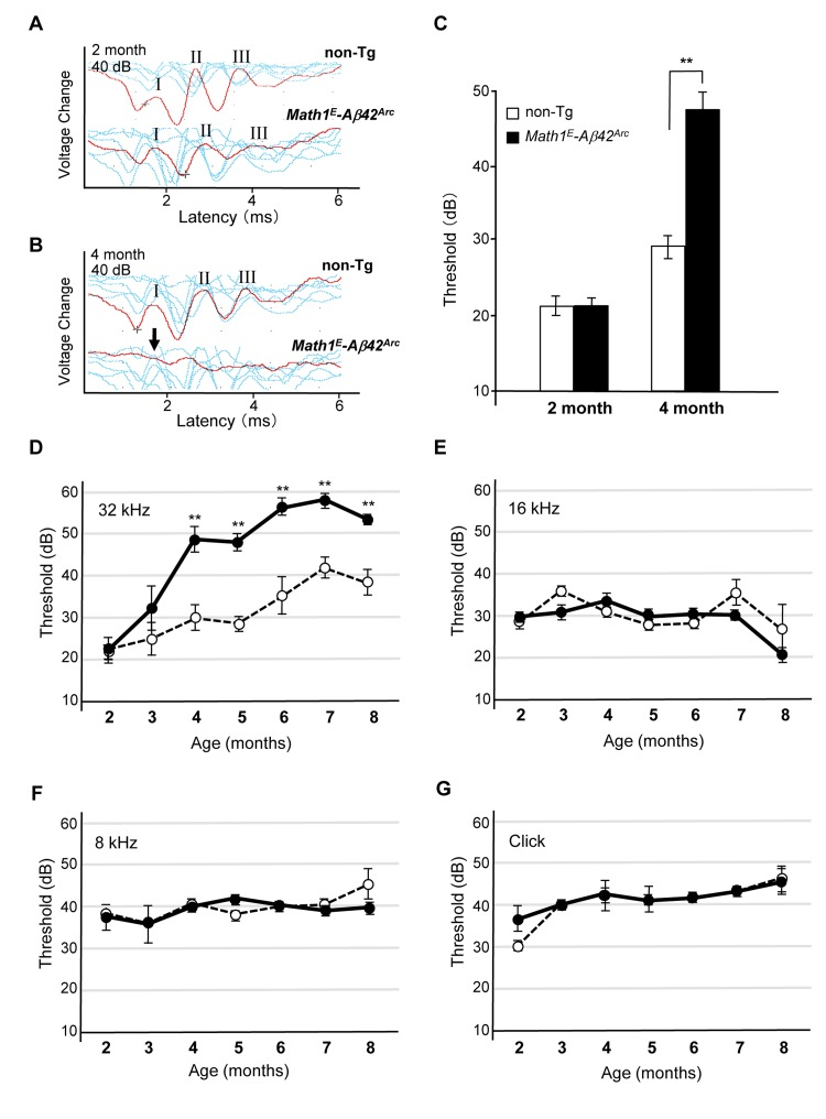 Tg(Math1E-Aβ42Arc)1Lt/129 mice showed dramatic hearing impairment for high-frequency sound over time