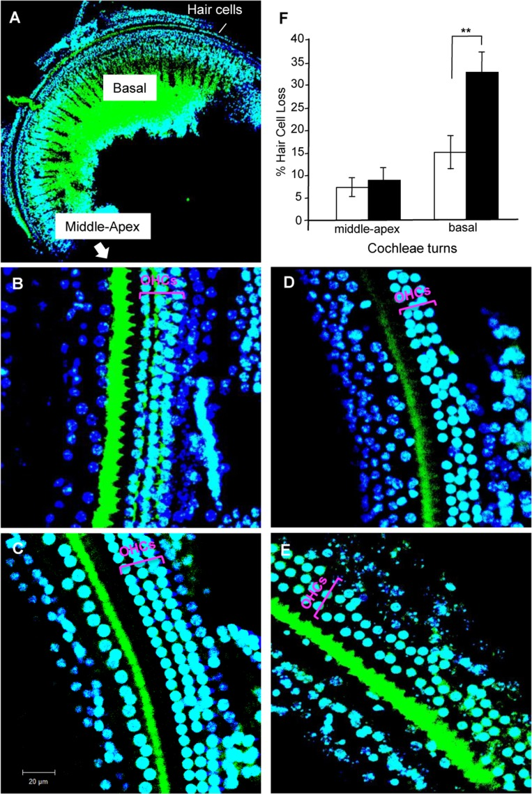 Hair cell loss in cochleae of Tg(Math1E-Aβ42Arc)1Lt/129 mice and control non-Tg siblings at age 8 months