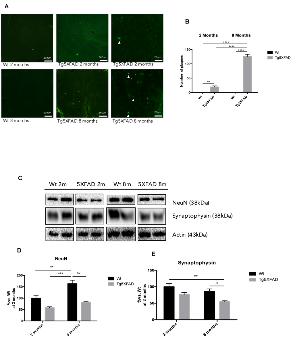 Histological images of amyloid plaques stained with thioflavin-S in female mice aged 2 and 8 months (Wt and 5XFAD). There is a heavy load of plaques in the majority of the brain areas ilustrated in 5XFAD the brain section (A). Representative Western blot for NeuN (B, C) and Synaptophysin (D, E). Bars represent mean ± Standard Error of the Mean (SEM), n = 4 for each group; DG: Dentate Gyrus. Scale bar for histochemical images is indicated in the Picture; *p