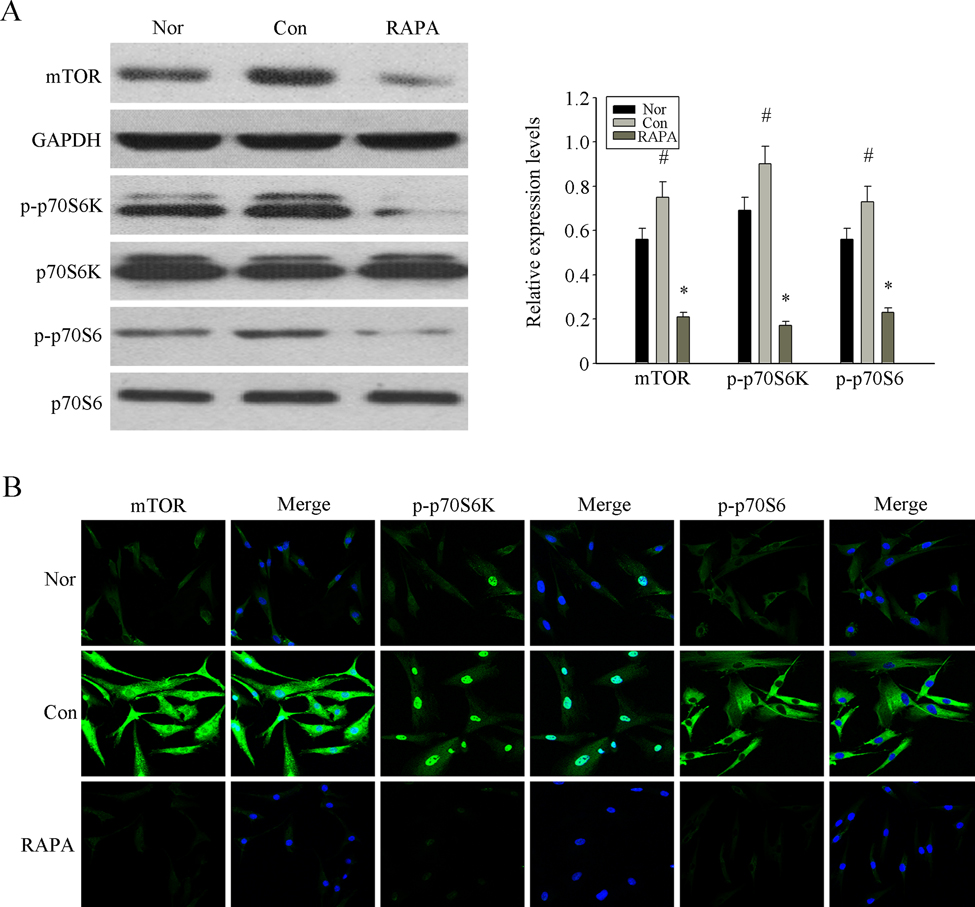 RAPA inhibited the over-activation mTOR pathway to revers the senescence of MSCs from MRL/lpr mice