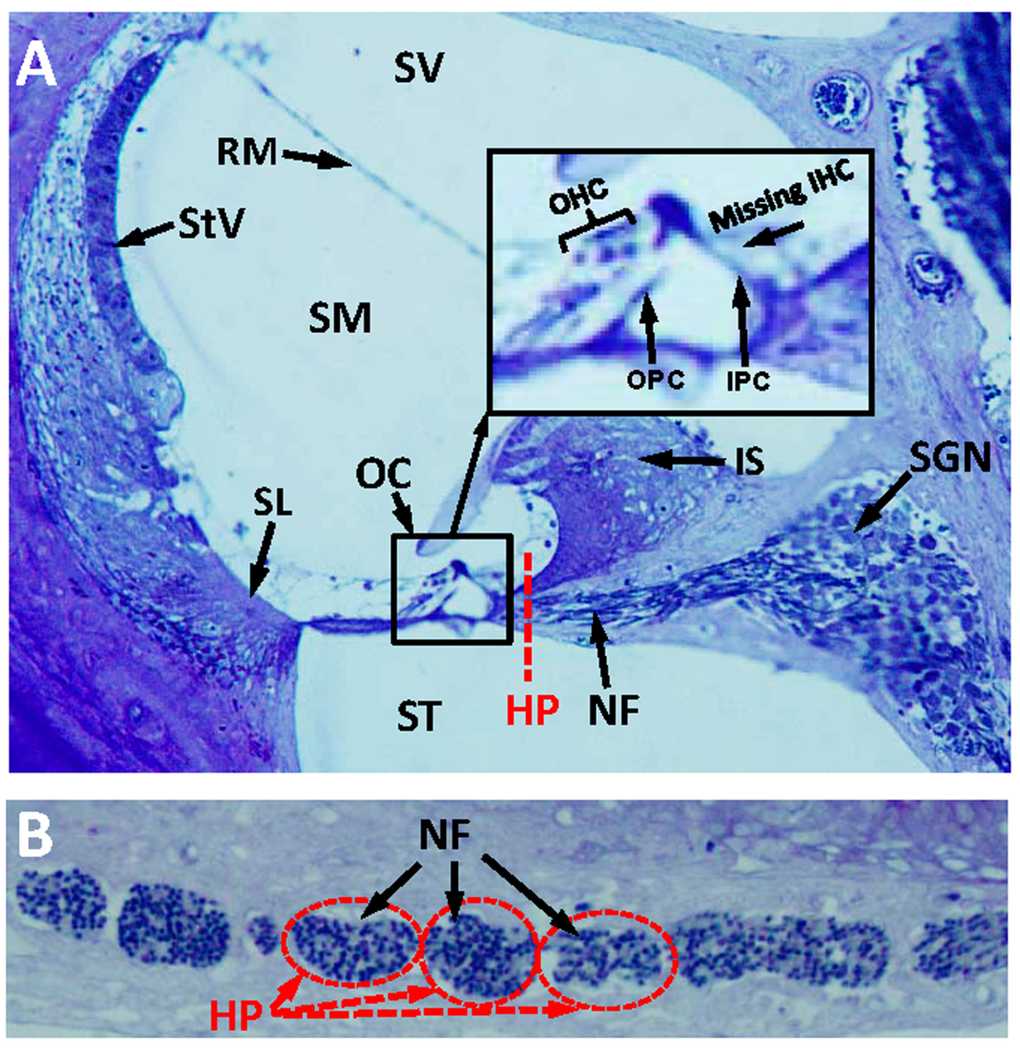 Radial section of cochlea showing missing IHC, but intact nerve fibers in the habenula perforata