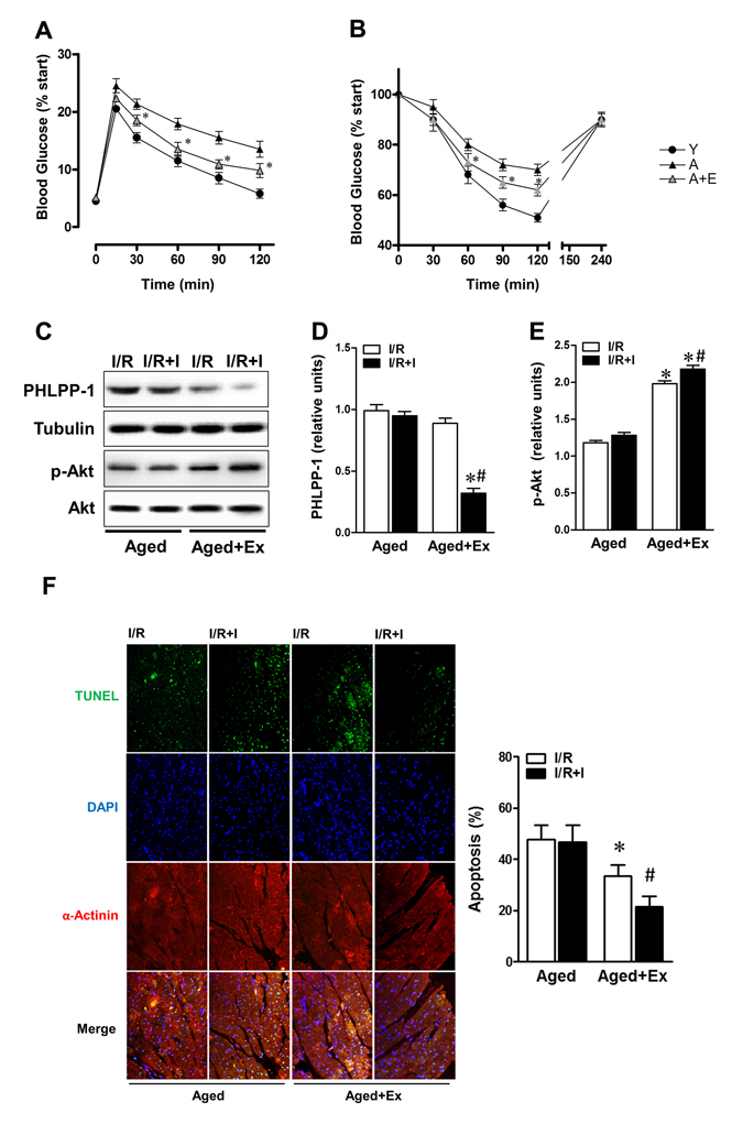 Exercise training reversed response to insulin of aged hearts