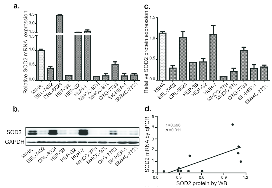 SOD2 expression is decreased in HCC and cell lines