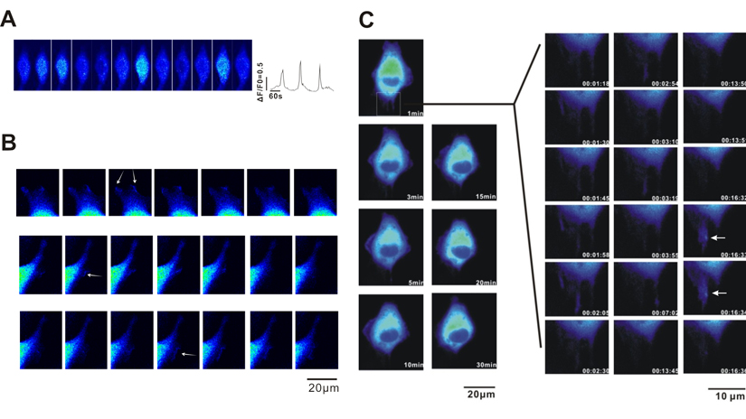 Observation of spontaneous Ca2+ transient in A549 cells