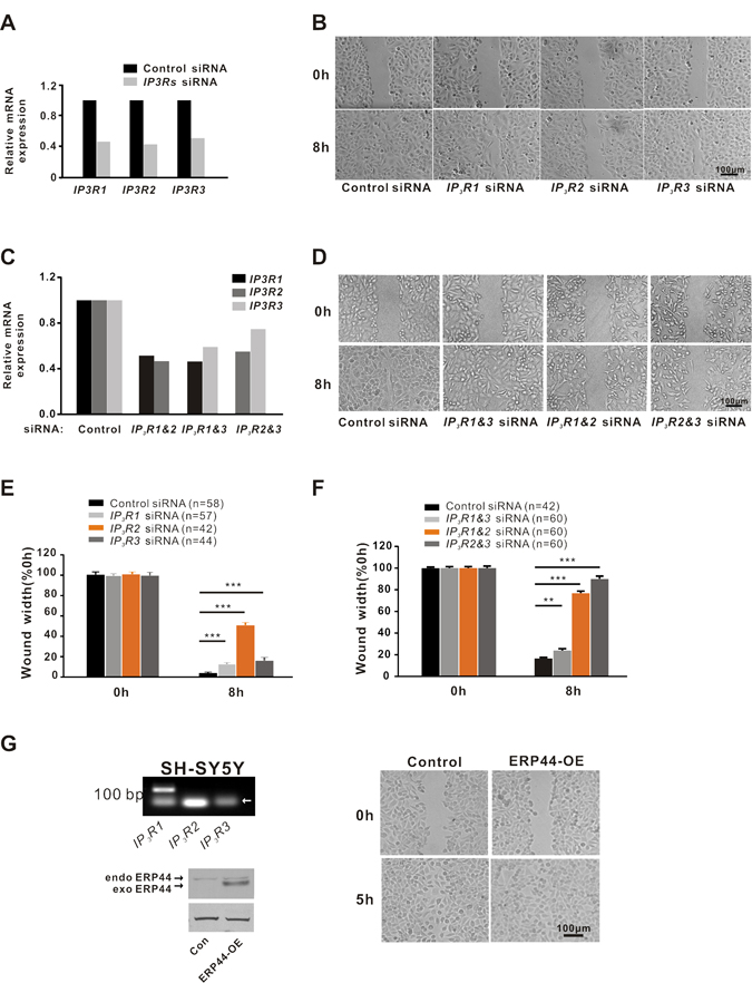 IP3R2 plays a dominant role in regulating A549 cell migration