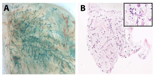 Senescent mammary cells “reprogram” neuronal stem cells in vivo