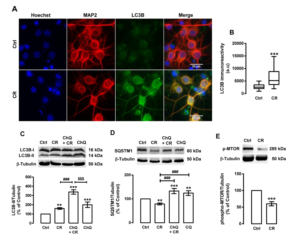 Caloric restriction increases autophagy in rat cortical neurons. Primary rat cortical neurons were exposed to caloric restriction mimic medium (CR), DMEM low glucose, for 6 h. Untreated cells were used as control (Ctrl). (A) LC3B puncta immunoreactivity was assessed by immunocytochemistry, as described in Materials and Methods. Cells were immunolabeled for LC3B (green) and MAP2 (red). Nuclei were stained with Hoechst 33342 (blue). Figures are representative of three independents experiments. Scale bar, 20 μM. (B) Quantification of LC3B puncta immunoreactivity (green) per cell in each condition (>20 cells per group). ***pC, D and E) Cells were incubated with chloroquine (ChQ, 100 μM), a lysosomal degradation inhibitor, 30 min before caloric restriction medium for 6 h. Whole cell extracts were assayed for LC3B-II (C), SQSTM1 (D), phospho-MTOR (p-MTOR) (E) and β-tubulin (loading control) immunoreactivity through Western blotting analysis, as described in Materials and Methods. Representative Western blots for each protein are presented above each respective graph. The results represent the mean ± SEM of, at least, five independents experiments, and are expressed as percentage of control. **p###p$$$p