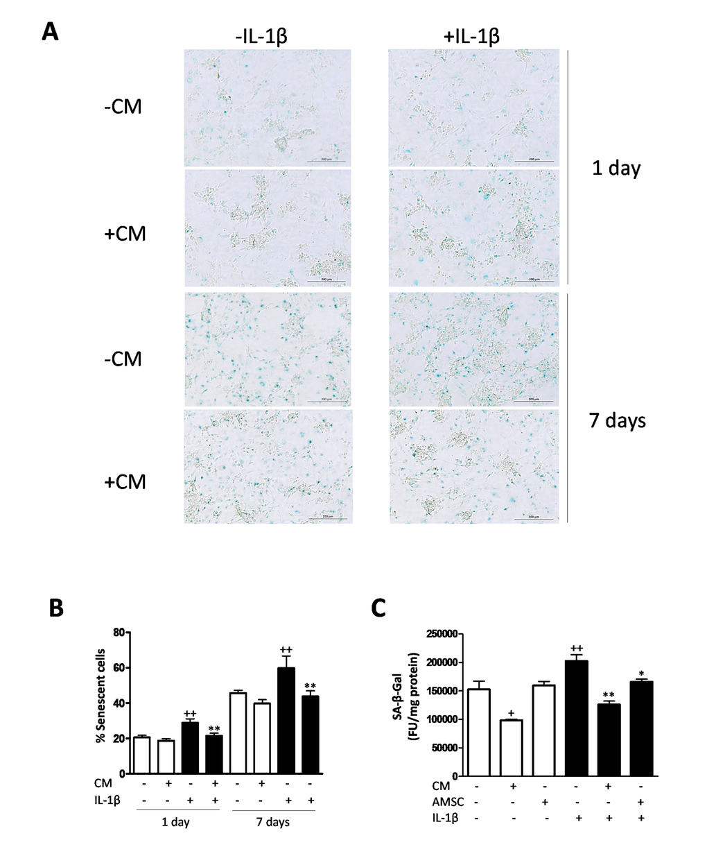 Induction of SA-β-Gal by IL-1β in OA chondrocytes. (A) Representative light microscopy images of cells stained with the senescent marker SA-β-Gal in monolayer cultures of OA chondrocytes. Bars: 200 μm. (B) Percentage of SA-β-Gal positive cells. OA chondrocytes were incubated with IL-1β and/or CM for 1 day and 7 days. ((C) SA-β-Gal was quantified by fluorometry. A co-culture system of AMSC and OA chondrocytes was used. Data are shown as mean±standard deviation of N=4 separate experiments with cells from separate donors. +p