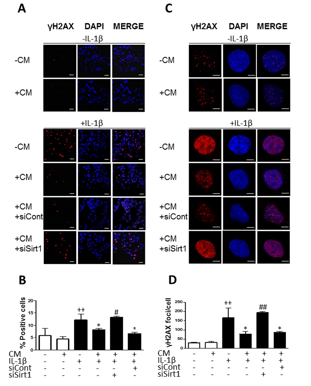 Effect of Sirt1 siRNA on the reduction of γH2AX foci accumulation by CM. (A) Representative experiment showing that Sirt1 siRNA (siSirt1) inhibits the effect of CM on the accumulation of γH2AX (red pixels) positive cells induced by IL-1β. siCont: non-specific siRNA. DAPI was used to stain the nuclei. Bars: 50μm. (B) Percentage of positive cells. (C) Representative experiment showing that Sirt1 siRNA (siSirt1) inhibits the effect of CM on the accumulation of γH2AX (red pixels) foci per cell induced by IL-1β. siCont: non-specific siRNA. DAPI was used to stain the nuclei. Bars: 5μm. (D) Number of γH2AX foci per cell. OA chondrocytes were incubated with the indicated treatments for 3 days. Data are shown as mean±standard deviation of N=4 separate experiments with cells from separate donors. ++p