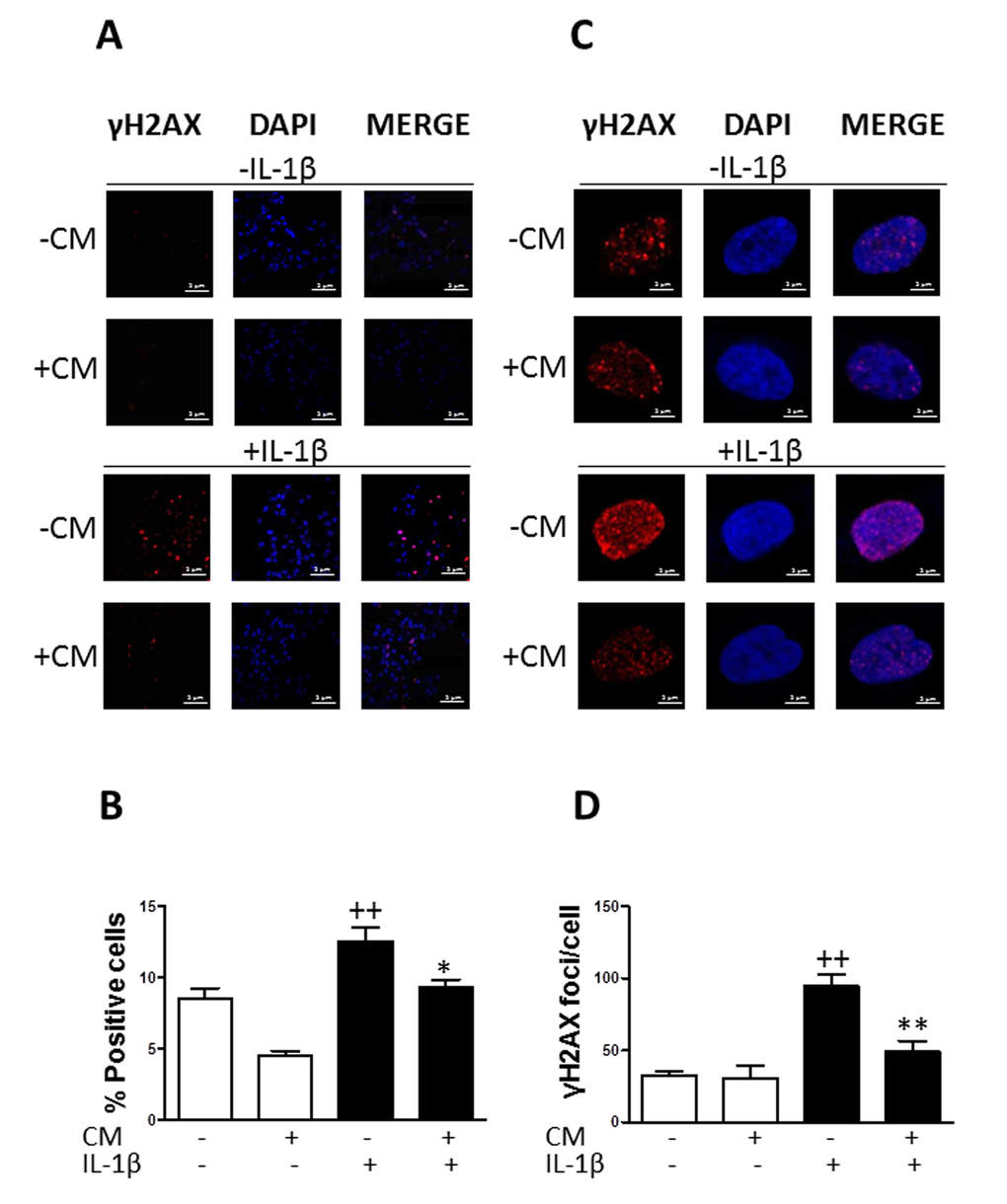 Effect of CM on γ-H2AX foci accumulation induced by IL-1β in OA chondrocytes. (A) Presence of γH2AX (red pixels) positive cells in a representative experiment. DAPI was used to stain the nuclei. Bars: 50μm. (B) Percentage of positive cells. (C) Presence of γH2AX (red pixels) foci in cell nucleus in a representative experiment. DAPI was used to stain the nuclei. Bars: 5μm. (D) Number of γH2AX foci per cell. OA chondrocytes were incubated with IL-1β and/or CM for 3 days. Data are shown as mean±standard deviation of N=4 separate experiments with cells from separate donors. ++p