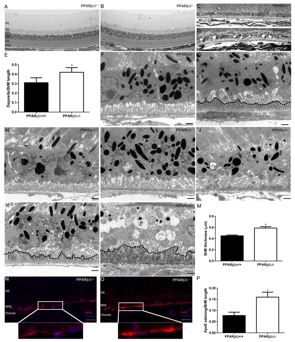 18-month old Pparβ/δ−/− mice exhibit dry-AMD pathology. Toluidine blue stained images of plastic sections from 18-month old (A)Pparβ/δ+/+ and (B)Pparβ/δ−/− mice displaying retinal layers (IPL: Inner plexiform layer, INL: Inner nuclear layer, OPL: Outer plexiform layer, ONL: Outer nuclear layer, OS: photoreceptor outer segments, RPE: Retinal pigment epithelium). Toluidine blue stained images of the outer retina of (C)Pparβ/δ+/+ and (D)Pparβ/δ−/− mice, which have sub-RPE deposits (Scale bar = 10 μm). (E) Quantification of deposits per Bruch’s membrane (BrM) length in plastic sections (mean and S.E.M., n=10 images/animal, n=4/genotype, * pPparβ/δ+/+ mice display (F) normal RPE morphology (G) with some age related deposits (dotted line), whereas 18-mo-old Pparβ/δ−/− mice show (H) RPE hypo-pigmentation, (I) hyper-pigmentation and (J) abnormal basal infoldings with thin sub-deposits, (K) loss of basal infoldings with thin and (L) thick sub-RPE deposits (dotted line). (M) Quantification of Bruch’s membrane thickness in electron micrographs of Pparβ/δ+/+ and Pparβ/δ−/− mice (n = 10 images per mouse, n = 4 mice per genotype, two tailed t-test). Scale bars in panels F-L: 1 μm. Images of apolipoprotein E (apoE; red) stained sections from (N)Pparβ/δ+/+ and (O)Pparβ/δ−/− mice (Scale bar: 20 μm). Nuclei are stained with Hoescht (blue). (P) Quantification of ratio of apoE stained regions/Bruch’s membrane length (mean and S.E.M., n=4 per group, * p 