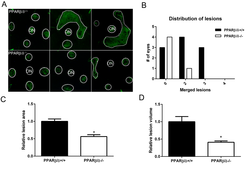 Genetic disruption of PPARβ/δ attenuates laser-induced CNV. (A) Choroidal flat-mounts were prepared from 18–20 month-old laser-induced CNV mice (Pparβ/δ+/+, n = 10 eyes, 40 lesions; Pparβ/δ−/−, n=5 eyes, 20 lesions) and stained with isolectin GS-IB4 (ON, optic nerve). Representative images from three eyes/genotype are shown to demonstrate individual and merged CNV lesions. Dotted and solid line circles demarcate lesions and optic nerves, respectively. (B) Distribution of number of eyes with individual versus merged lesions in Pparβ/δ+/+ and Pparβ/δ−/−. (C) Relative lesion area/animal was measured using ImageJ (mean and S.E.M.; *p  0.01, two tailed t-test). (D) Relative lesion volume/animal (mean and S.E.M. for each group; *p  0.05, two tailed t-test).