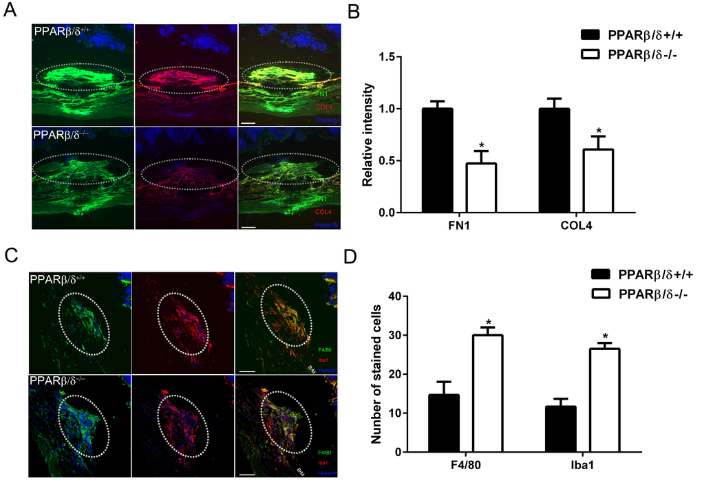 PPARβ/δ regulates extracellular matrix deposition and immune-cell infiltration in CNV lesions. (A) FN1 (green) and COL4 (red) immunolocalization in CNV lesions of Pparβ/δ+/+ and Pparβ/δ−/− mice (dotted oval demarcates the lesion area; nuclei are stained blue with Hoechst; representative images are shown; scale bar = 50 µm). (B) FN1 and COL4 staining intensity was quantified in the CNV lesions of Pparβ/δ+/+ and Pparβ/δ−/− mice using ImageJ (mean and S.E.M.; n = 3/group; **p  0.01, two tailed t-test). (C) Laser CNV lesions from Pparβ/δ−/− mice display a higher number of F4/80 (green) and Iba1 (red) immunopositive cells (dotted oval demarcates the lesion area; nuclei are stained blue with Hoechst; representative images are shown; scale bar = 50 µm). (D) The numbers of F4/80+ and Iba1+ cells in the CNV lesions of Pparβ/δ+/+ and Pparβ/δ−/− mice were counted using ImageJ (mean and S.E.M.; n = 3/group; *p  0.01, two tailed t-test).