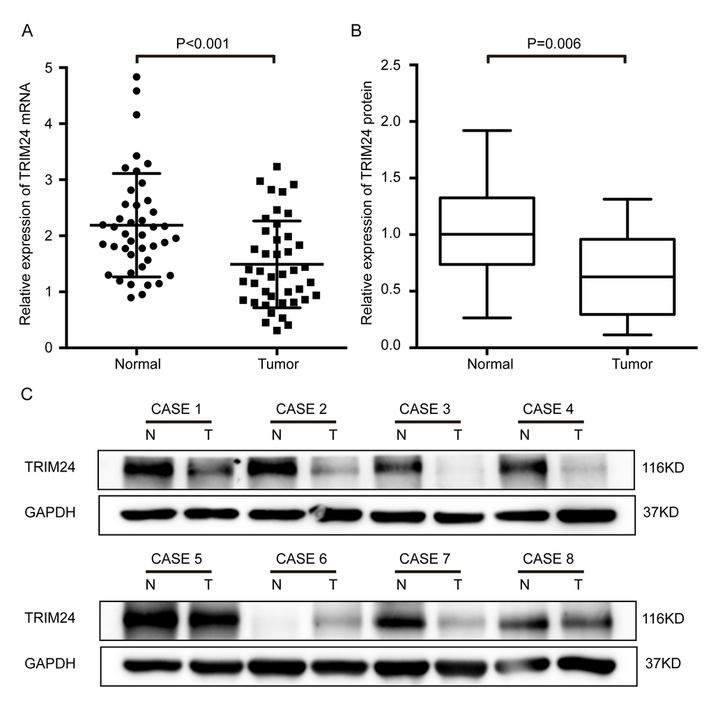 Expression levels of both TRIM24 protein and mRNA were significantly lower in ESCC tissues than in the matched adjacent non-cancerous tissues (NCET) of the same patients. (A) Comparison of the relative expression levels of TRIM24 mRNA in 42 pairs of ESCC and NCET samples, which were examined by RT-PCR (mean ± SD, Paired t test, PB) Comparison of the expression levels of TRIM24 protein in 19 pairs of ESCCs and the matched NCETs, which were detected by Western blot. (C) Protein levels of TRIM24 in eight representative ESCC tissues (T) and paired adjacent NCET (N) were analyzed by Western blotting.