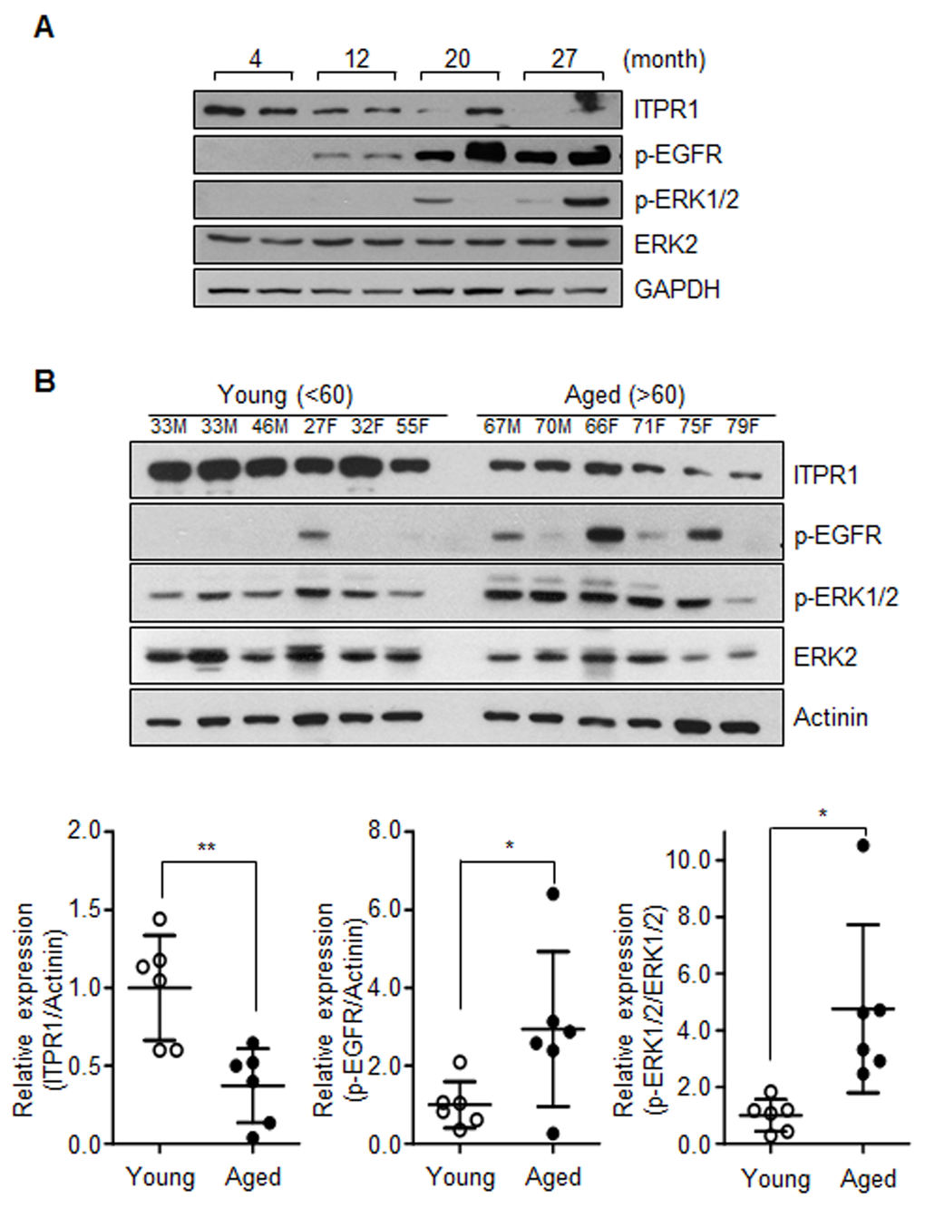 Activation of the EGFR-Ras-ERK pathway in aged muscle. (A) Immunoblot analysis of quadriceps tissue extracts from 4, 12, 20, 27 months mice with anti-ITPR1, anti-phospho EGFR, anti-phospho ERK1/2, and anti-ERK2 antibodies. GAPDH was used as the loading control. n = 2 for each group. (B) Immunoblot analysis of human quadriceps (vastus lateralis) derived from young and aged individuals with anti-ITPR1, anti-phospho EGFR, anti-phospho ERK1/2, and anti-ERK2 antibodies. Actinin was used as the loading control. Young subjects represented individuals less than 60 years of age while aged subjects were greater than 60 years of age. n = 6 for each group.