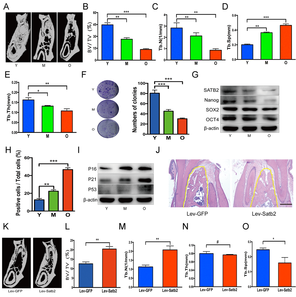 SATB2-modified BMSCs prevent alveolar bone loss of aging rats. (A) The region of molar furcation in rats mandible demonstrated a significantly reduced bone mass with aging. (B) Bone histomorphometric parameters revealed a decrease in BV/TV, (C) Tb.N., (D) Tb.Th. and (E) an increase in Tb.Sp. (F) BMSCs from rats mandible showed a declined colony-forming units with aging. (G) Western blots showed the decrease of SATB2, Nanog, SOX2 and OCT4 expression with aging. (H) SA-β-Gal positive cells and senescence-related factors P16, P21 and P53 (I) increased with aging. (J) HE staining demonstrated abundant trabecular bone in Lev-satb2 group compared with Lev-GFP group (alveolar bone showed in yellow line). (K-O) Histomorphometric analysis of alveolar trabecular bone after treatment with BMSCs, representative micro-CT images (K), BV/TV (L), Tb.N. (M), Tb.Sp (O), and Tb.Th(N) between Lev-GFP group and Lev-satb2 group. #p> 0.05, *p
