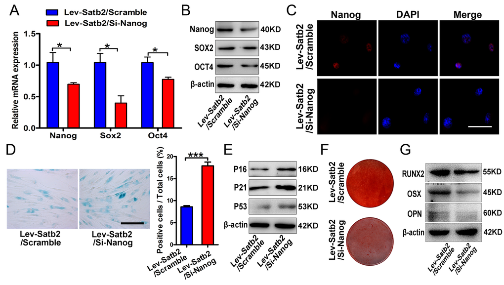 SATB2 regulated age-related properties of AB-BMSCs by Nanog pathway. (A, B) Real-time PCR and western blot results showed the decrease of Nanog, SOX2 and OCT4 expressions after Nanog knockdown in AB-BMSCs with SATB2 overexpression (Lev-Satb2/Si-Nanog) in relative to control (Lev-Satb2/Scramble). (C) Immunofluorescence staining verified Nanog reduction upon Nanog knockdown mediated by siRNA. (D, E) Nanog knockdown increased the number of SA-β-Gal positive cells and P16, P21 and P53 abundance in AB-BMSCs with SATB2 overexpression. (F, G) Nanog knockdown largely abrogated the effects of SATB2 overexpression in AB-BMSCs from older donors as demonstrated by weaker Alizarin red staining and reduced RUNX2, OSX and OPN expression. *p