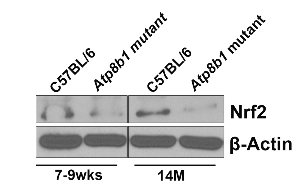 Western blot analysis of Nrf2. Equal amounts of protein from C57BL/6 and Atp8b1 mutant lung homogenates (7-9 wks and 14 M timepoints) were separated on 10% SDS-PAGE and probed with anti-Nrf2 antibody. There was no change in Nrf2 protein levels at 7-9 wks in both the groups. There was a significant decrease in Nrf2 protein in Atp8b1 mutant lungs at 14 M compared to C57BL/6 control. This is a representative blot. The experiment was repeated three times. β–Actin used as a loading control shows equal loading in all the lanes.