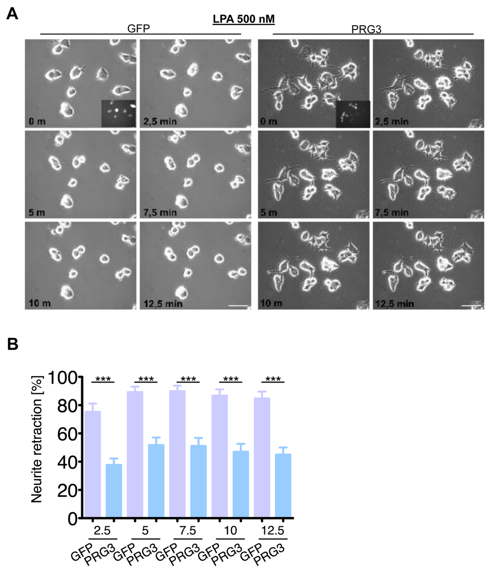 PRG3 impedes lysophosphatidic acid (LPA) induced axon collapse. (A) Live time collapse assay with axon collapse inducing LPA. Representative time laps microscopy image series of GFP and PRG3 expressing neurons treated with 0.5 µM LPA. Transfection efficacy is shown in first image bottom right corner. Scale bar represents 50 µm. (B) Quantification of neurite length of neurons expressing GFP (control) or PRG3. Note, that GFP expressing neurons show significant higher number of retracted neurites and round cell bodies during the time lapse assay. Three independent experiments were carried out and differences were considered statistically significant with * pt-test). Values are given as mean ± SEM.