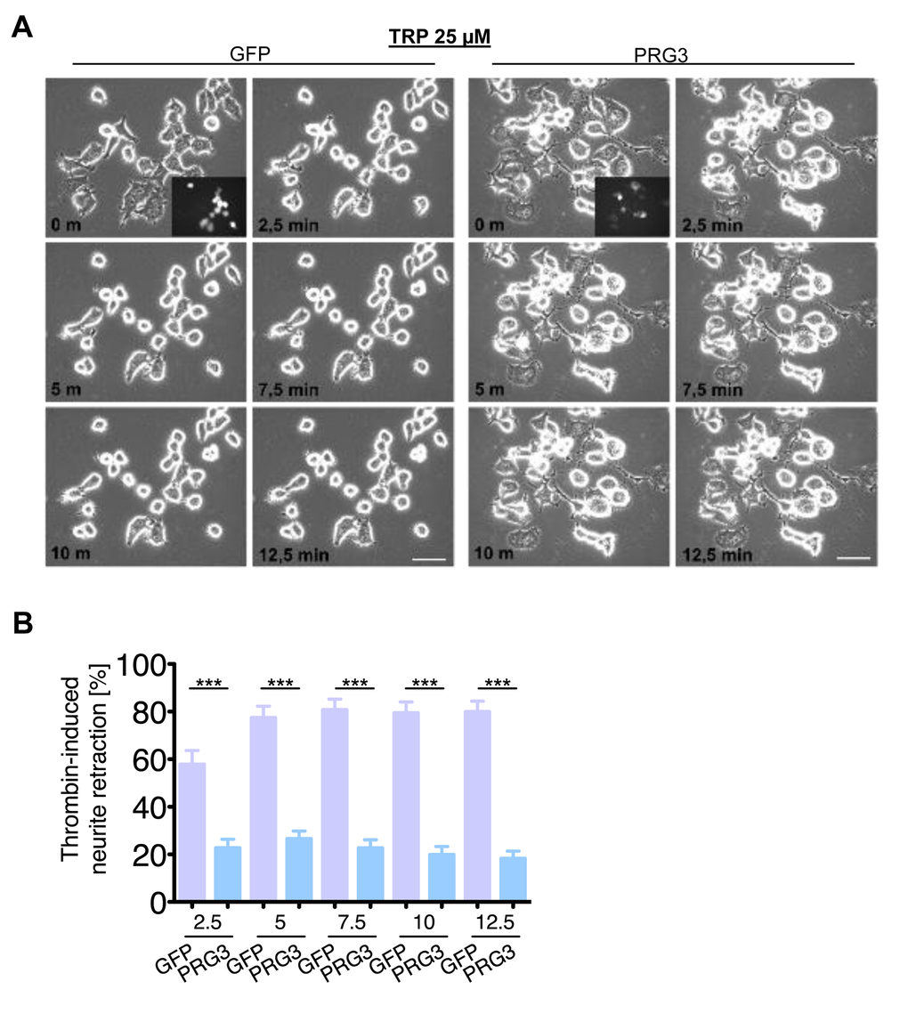 PRG3 impedes Thrombin-induced axon collapse. (A) Representative time laps microscopy image series of GFP and PRG3 expressing neurons treated with 25 µM Thrombin (TRP). Transfection efficacy is shown in first image bottom right corner. Scale bar represents 50 µm. (B) Quantification of neurite length of neurons expressing GFP (control) or PRG3. Three independent experiments were carried out and differences were considered statistically significant with * pt-test). Values are given as mean ± SEM.