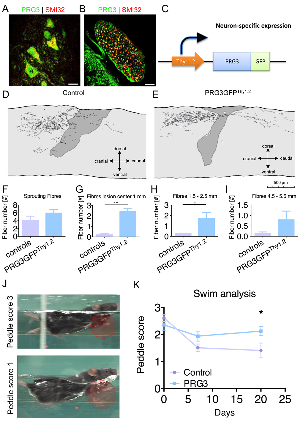 PRG3 is present in spinal cord neurons and contributes to spinal regeneration after spinal cord injury. (A-B) Double-immunocytochemistry showing that PRG3 is co-expressed with the motor neuron marker SMI32 (non-phosphorylated neurofilament) in murine spinal cord motor neurons in the ventral horn (A) and their axons in the ventral root (B). Scale: 20 µm. (C) Schematic illustration of the Thy1.2 driven PRG3GFP transgenic mouse, cDNA construct of PRG3-GFP was subcloned downstream of the artificial Thy1 neuronal specific promoter, the construct was introduced as transgene in 129S zygotes. (D-E) Camera lucida reconstruction of spinal cord hemisection performed in control n=4 (D) and PRG3 transgenic n=3 (E) animals. (F-I) Sprouting fibres (F) and fibres 1 mm (G), 1.5 – 2.5 mm (H) and 4.5 – 5.5 mm (I) rostral to the lesion analysis of control and PRG3 transgenic animals after dorsal hemisection based on camara lucida reconstructions. (J) Representative image of the swim test score 3 and 1 display functional locomotion recovery analysis. (K) Swim test analysis. Baseline swim analysis was performed before dorsal hemisection (time point 0). After 7 and 20 days, swim performance was again scored. PRG3 transgenic animals show significant increased swim performance 20 days post spinal cord lesion compared to controls. Data plotted as mean ± SEM. Statistical differences were analysed by two way anova with Bonferroni post hoc analysis including repeated measurement correction (n=5 per group). P value was set as * = p