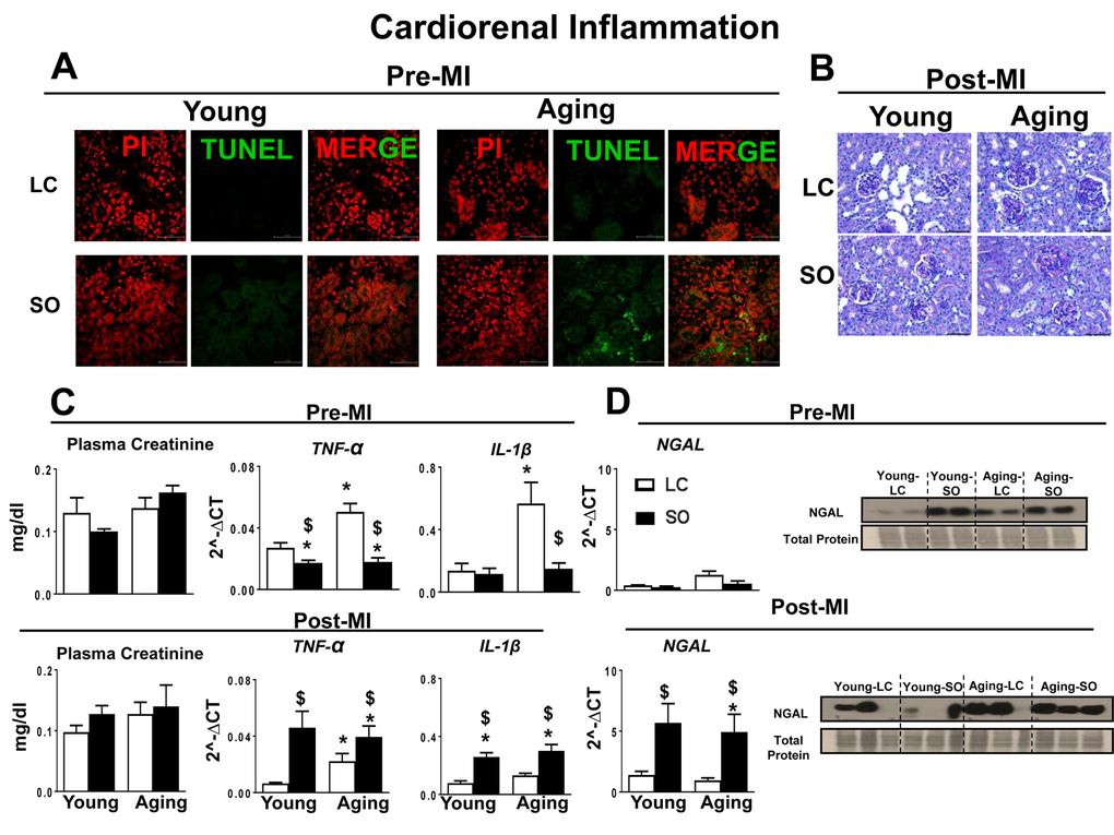 Post-MI impact of fatty acids during aging on cardiorenal-axis. (A) Immunofluorescence images representing TUNEL positive cells (green) in young and aging-SO fed mice. Nuclei are stained with propidium iodide (Red). (B) PAS staining indicates granulomatous kidney inflammation. (C) Pre- and post-MI plasma creatinine level and mRNA expression of TNF-α and IL-1β, in kidney. (D) Pre- and post-MI mRNA and protein expression of NGAL in kidney. *p