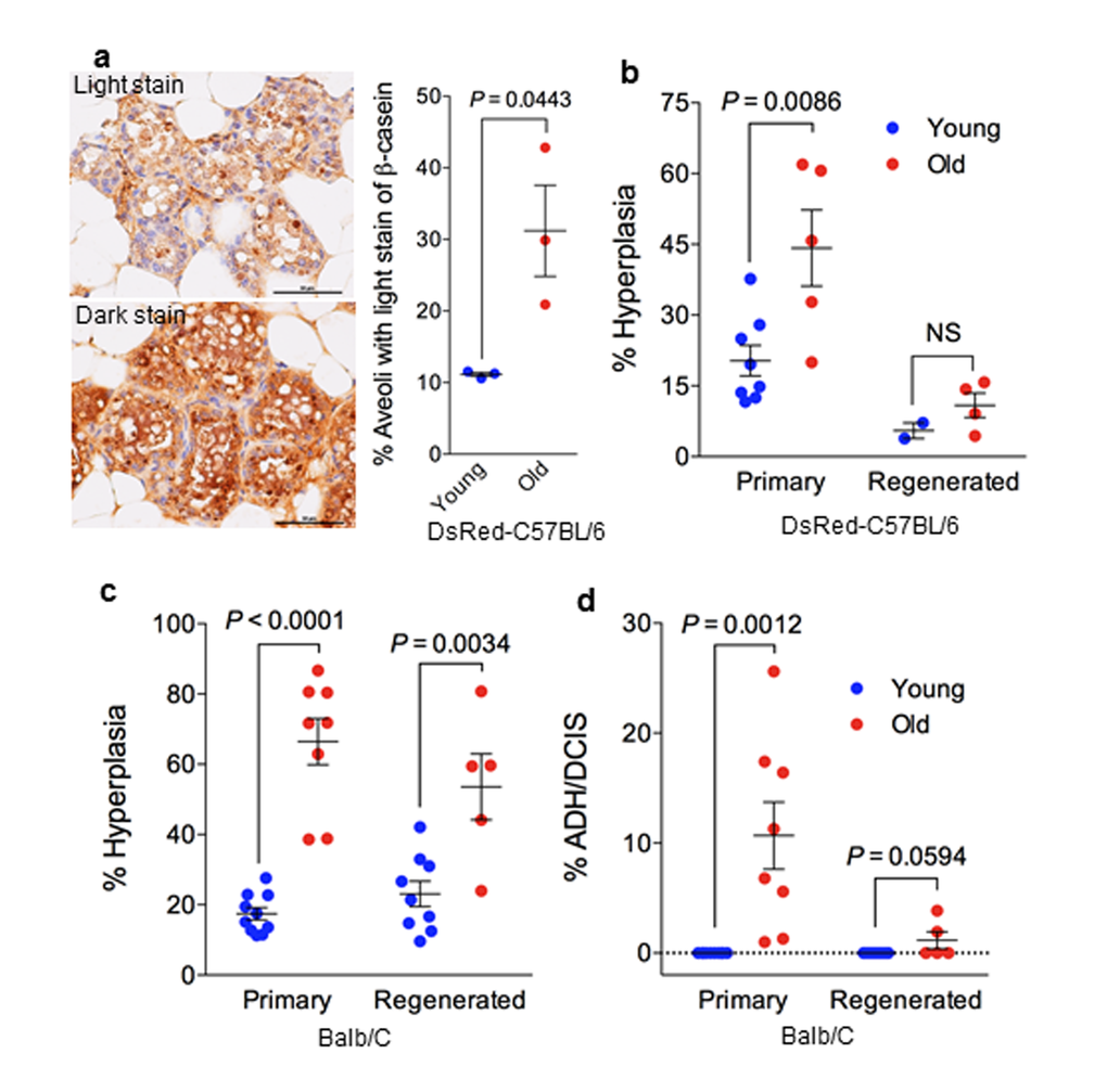 Stem cell function and transformation potential in young and old mammary glands. (a) Immunohistochemistry staining of β-casein showing more aveoli with light staining of β-casein in regenerated outgrowths derived from old MaSCs (26-29 mon.) than in those derived from young MaSCs (7-9 mon.) isolated from DsRed-C57BL6/J donor mice (n = 3 paired regenerated outgrowths from young and old MaSCs injected in the right or left side of the same recipient mice; paired t-test). (b) Frequency of preneoplastic lesions (expressed as % hyperplasia) in primary and MaSC-regenerated glands from young (7-9 mon.) and old (26-29 mon.) DsRed-C57BL6/J mice. (c) Frequency of preneoplastic lesions (expressed as % hyperplasia) and neoplastic lesions (% atypical ductal hyperplasia/ductal carcinoma in situ [ADH/DCIS]) in primary and MaSC-regenerated glands from young (2-4 mon.) and old (17-27 mon.) BALB/c mice.